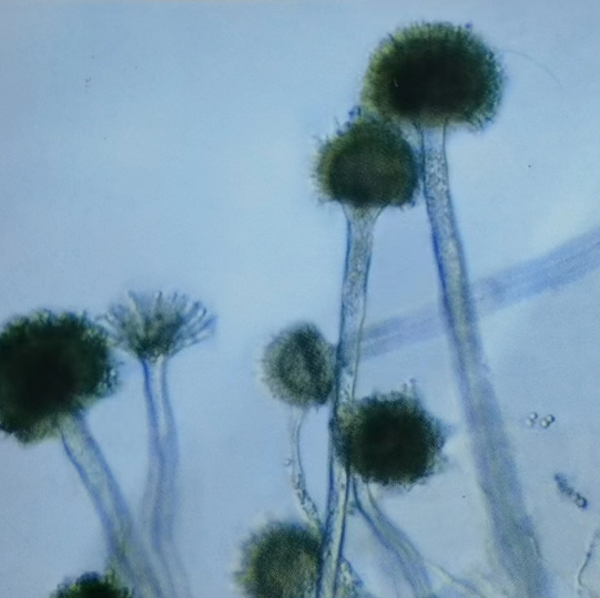 梅雨季养殖“隐形杀手”来袭，三招教您精准防控霉菌毒素！